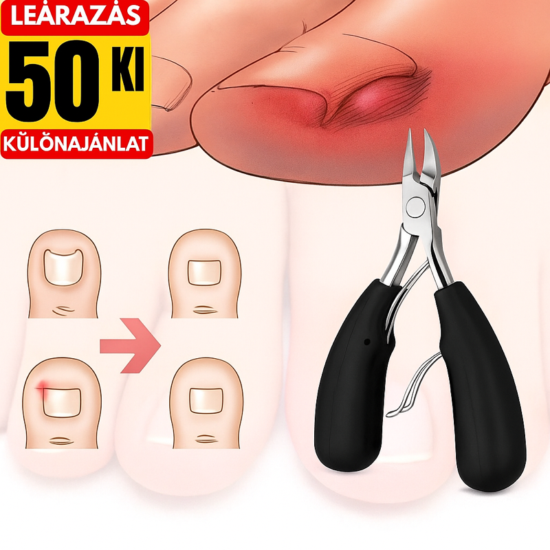 NailTrim Pro™ szett